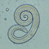 Trichinella spiralis - Wikipedia